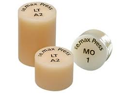 اینگات های دندانسازی